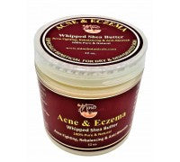 ACNE & ECZEMA WHIPPED SHEA BUTTER
